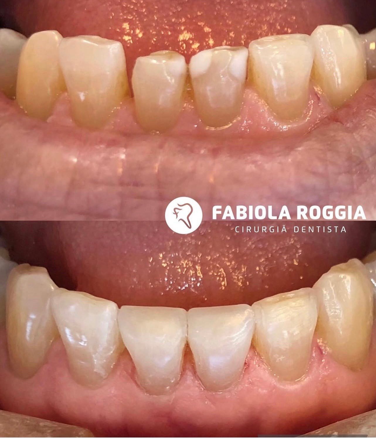 Restauracões estéticas