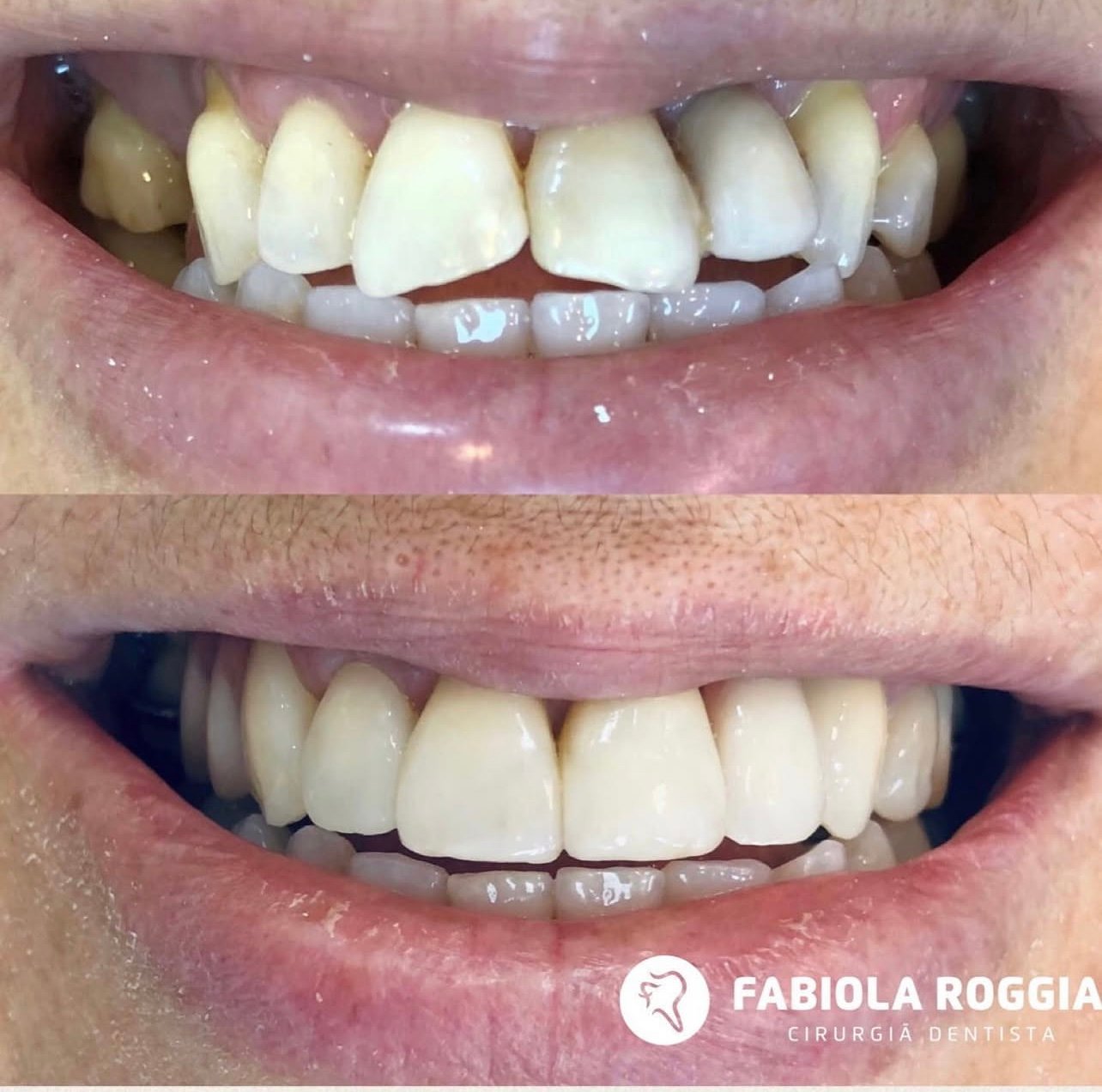 Restauracões estéticas